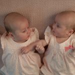 Hoe gaat het nu met de bijzondere tweeling die hand in hand werd geboren?