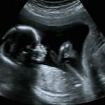 Filmpje: baby klapt in de baarmoeder mee met de muziek