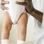 Hele kleine kans: donkere vrouw baart blanke baby