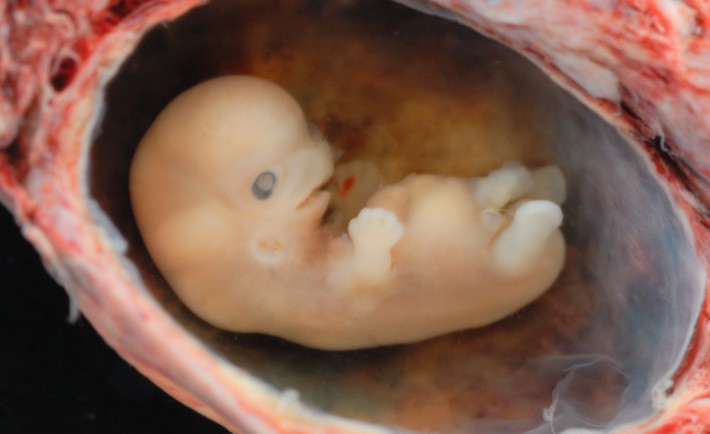 Embryo 6e week zwangerschap