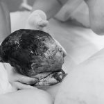 Fascinerende foto’s: de geboorte van het hoofdje van baby’s