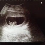 14 weken zwanger – update #1