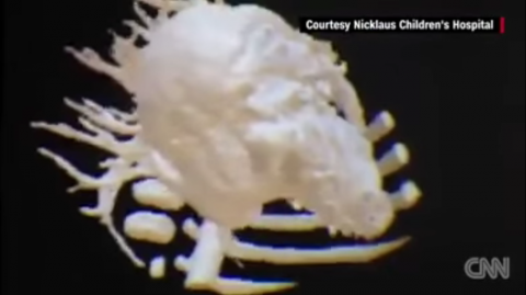 3D beelden van hart babytje