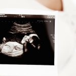 Wauw, deze 4d-echo toont prachtige beelden uit de baarmoeder