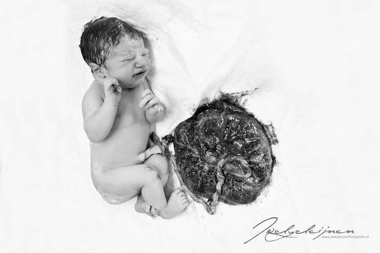 13 prachtige foto met placenta